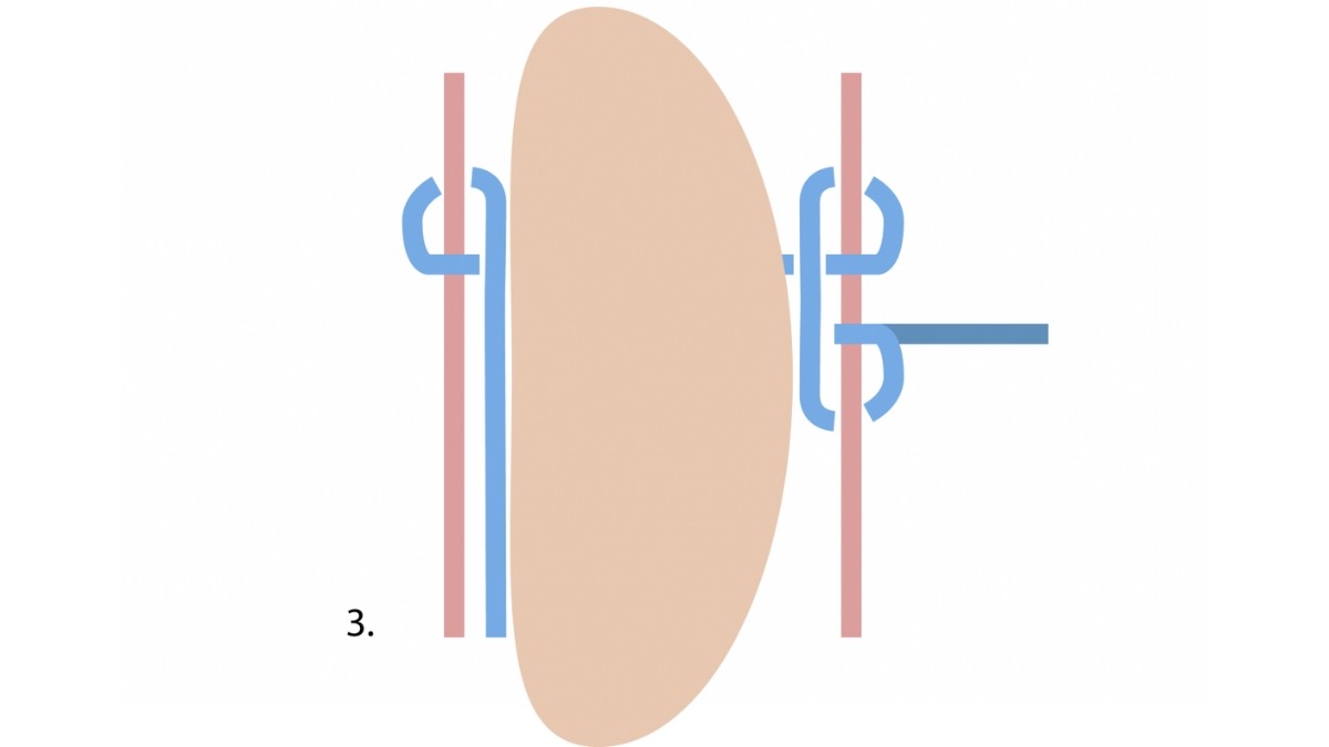 Comment sertir une pierre en macramé ? : Etape 3